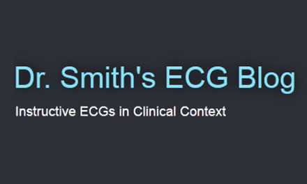 Dr_Smiths_ECG_blog.jpg