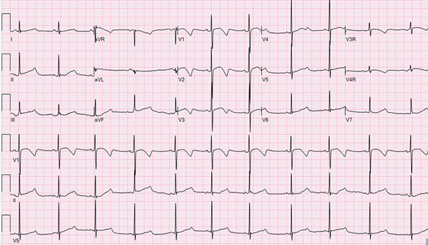 Qt Interval Chart