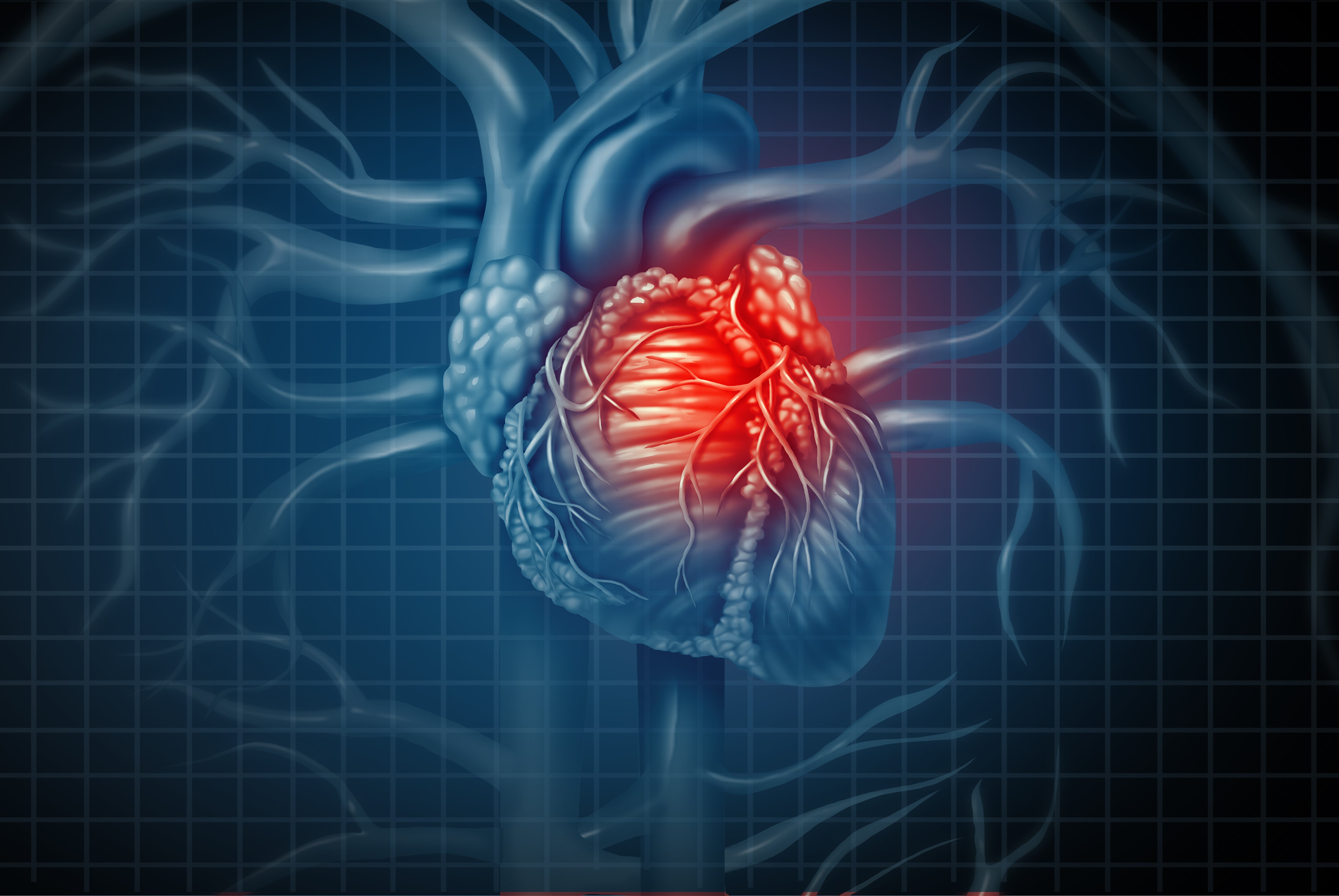 Critical Care Alert: Coronary Angiography after Cardiac Arrest without
