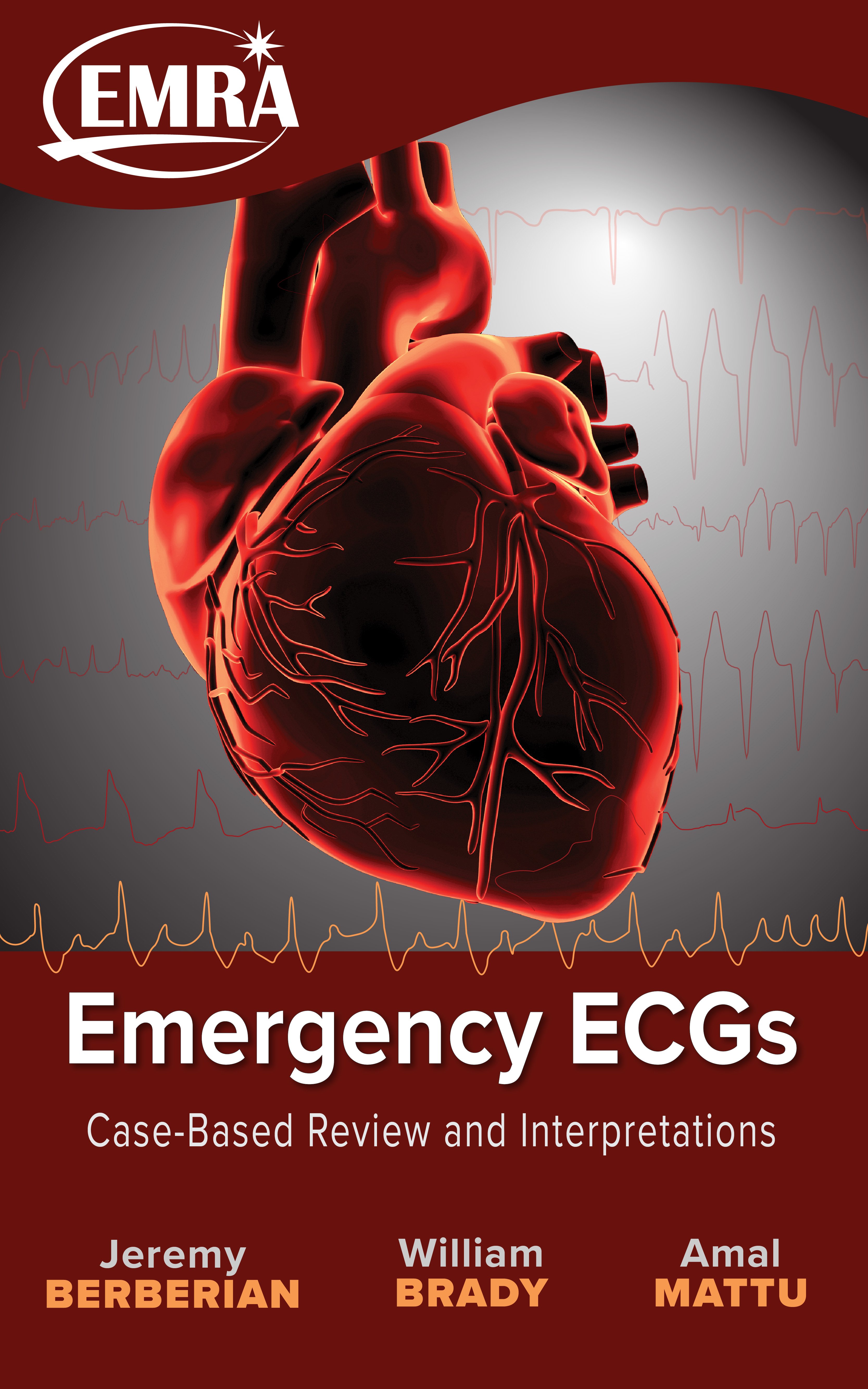 2021_Emergency_ECGs_Kindle.jpg