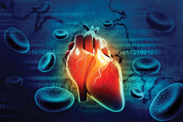 Aortenstenose: Der neueste Sündenbock für Herzinfarkte