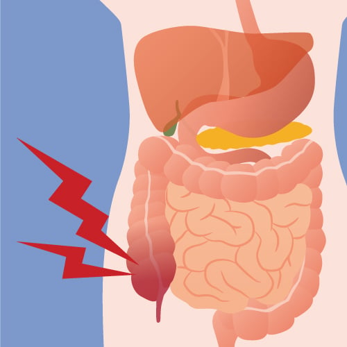 Principle of management of rt flank pain