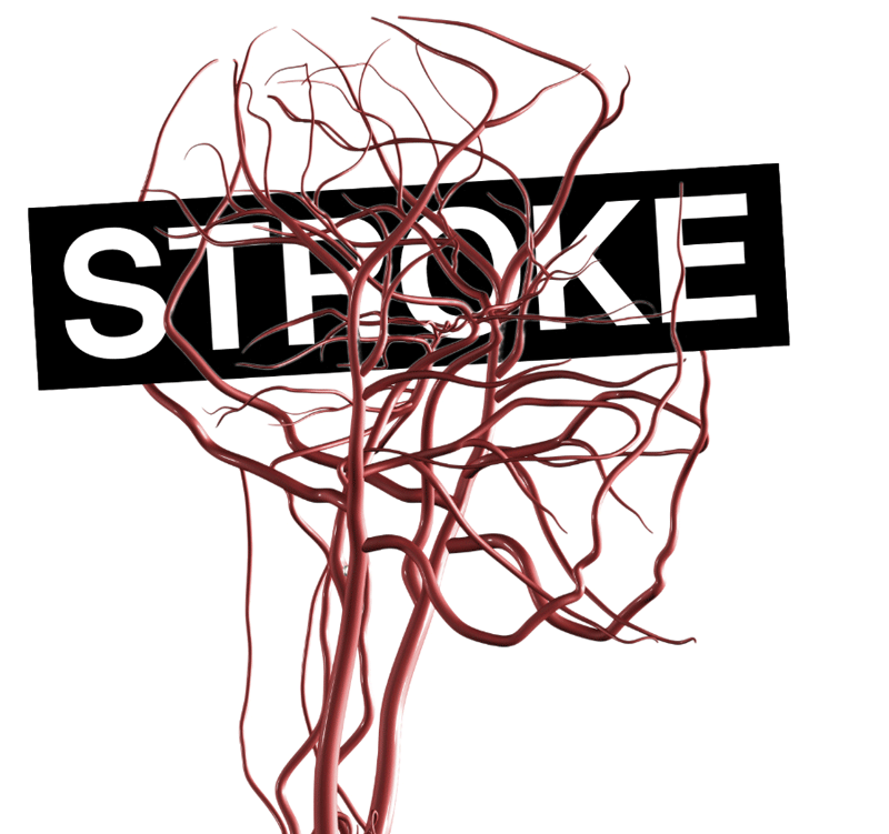 Stroke.png