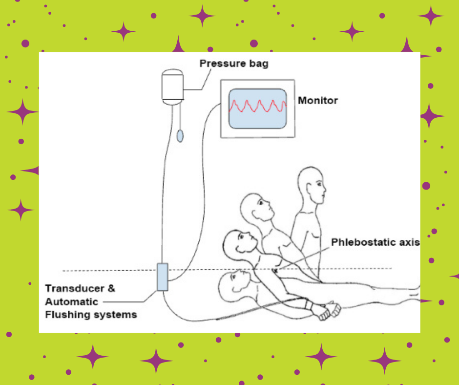 Critical Care Device Series: Arterial Lines Part 2 - Waveforms and Damping