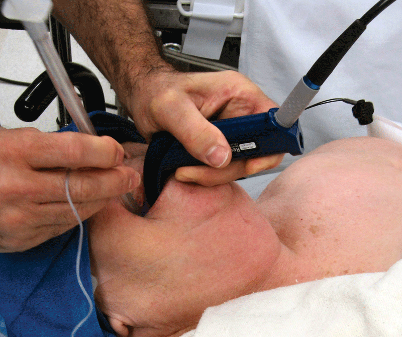 Glidescope Glidescope.png