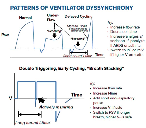 Demystifying Ventilator Alarms_Patterns of Ventilator Dyssynchrony.jpg