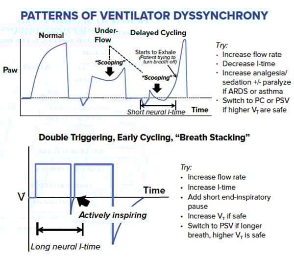 Demystifying Ventilator Alarms_Patterns of Ventilator Dyssynchrony.jpg