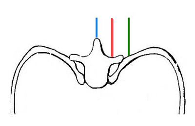 46-6 Ultrasound - Image 1 - spine-rib-anatomy-us-planes.jpg