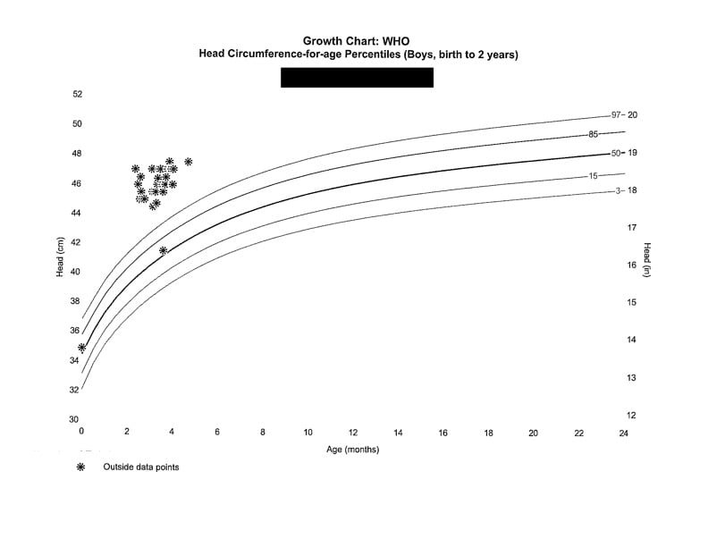 Pediatric Brain Abscess - Fig 1.jpg