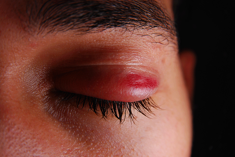 eye.png eye.png