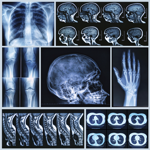 RadiologyJuneJuly2014.png