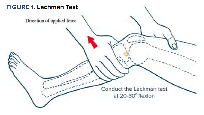 ACL Rupture Lachman Test