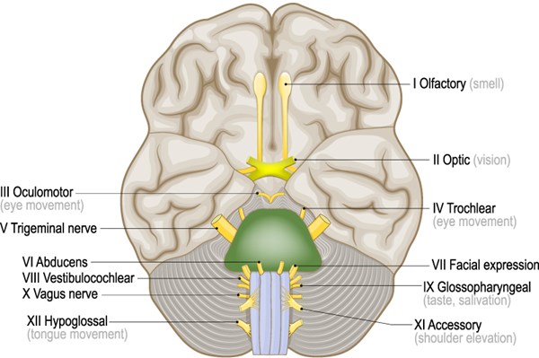 MRI Confirmed Bell's Palsy Presenting with Multiple Cranial Nerve