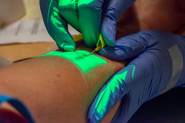 CCA - Peripheral IV for Vasopressors.jpg