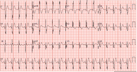 48-2 Blunt Cardiac Injury.jpg