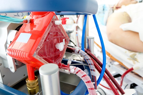 Critical Care Alert Effect Of Intra Arrest Transport Extracorporeal 