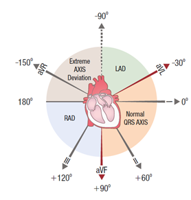 ekg guid picture 1.png