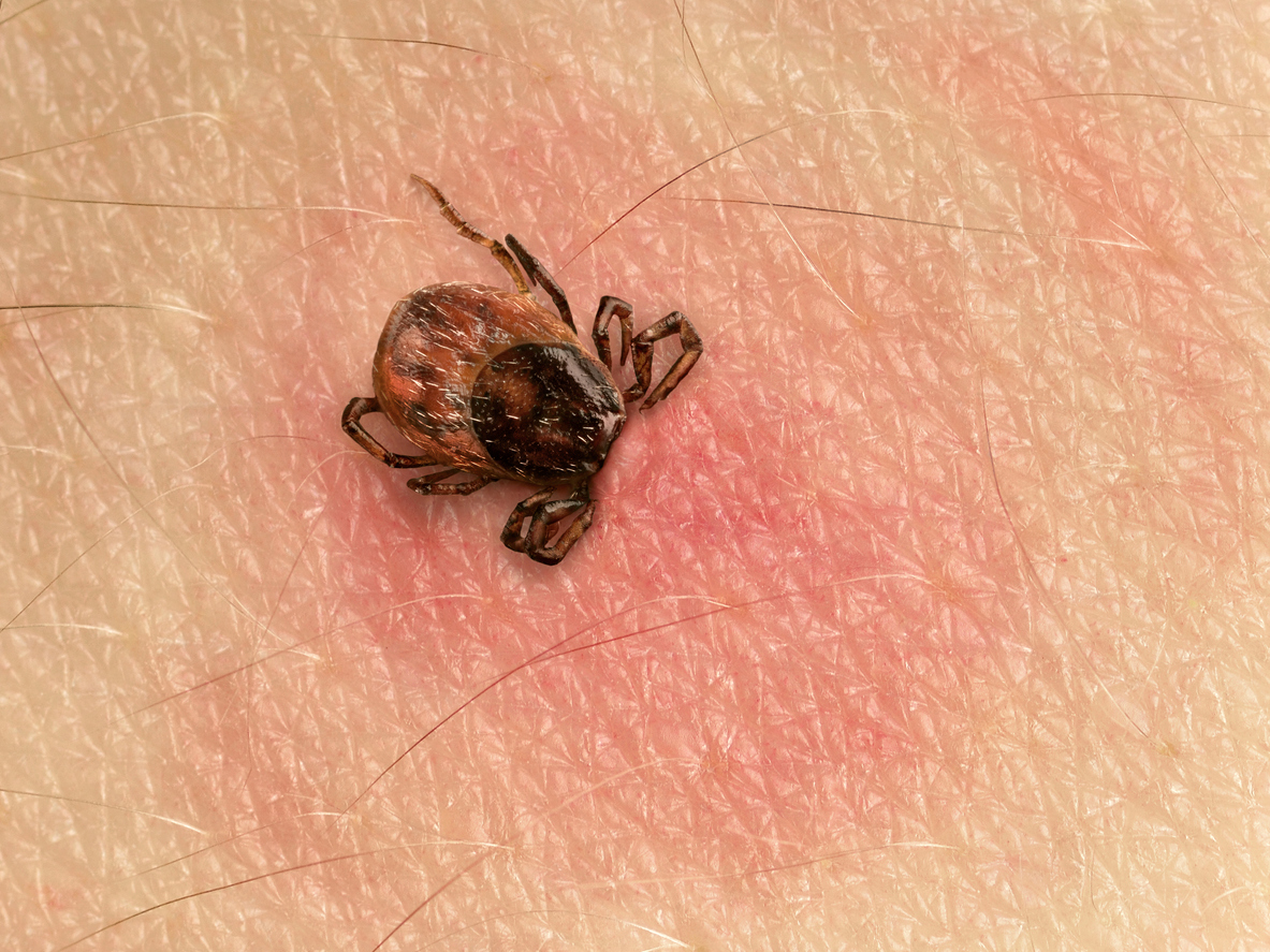 Lyme Disease.jpg