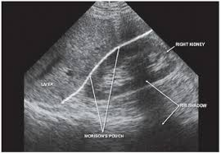 PoCUS-Figure-3.png