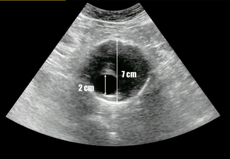 PoCUS-Figure-4.png