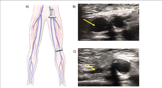 PoCUS-Figure-5.png