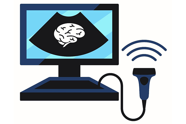 POCUS-Ultrasound.png