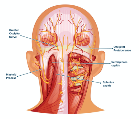 02 - Migraine - Illustration.png