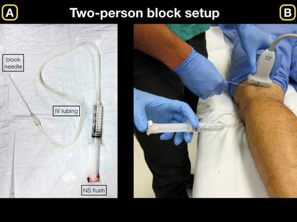 16 - US Guided Nerve Blocks - 001.jpeg