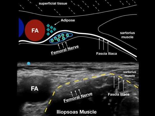 16 - US Guided Nerve Blocks - 002.jpeg