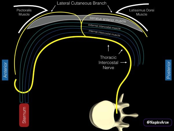 16 - US Guided Nerve Blocks - 004.jpeg