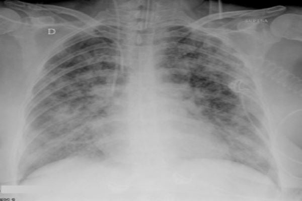 xray-2-e1453834982532.jpg