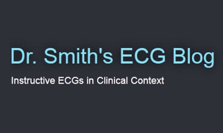 Dr_Smiths_ECG_blog.jpg
