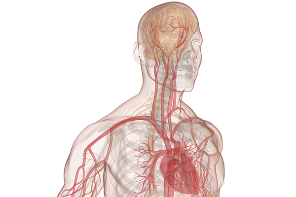 45-2_Subarachnoid Hemorrhage.jpg