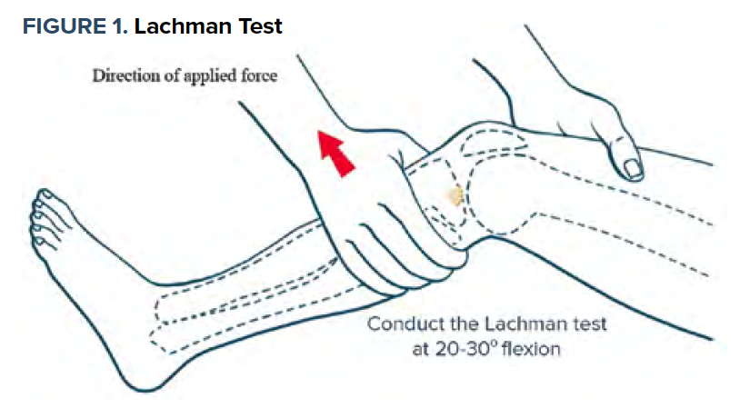 Тест Лахмана коленного сустава. Симптом Лахмана в коленном суставе. Тесты на коленный сустав
