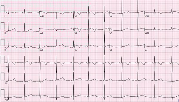 45-5 Pediatric ECG.jpg 45-5 Pediatric ECG.jpg