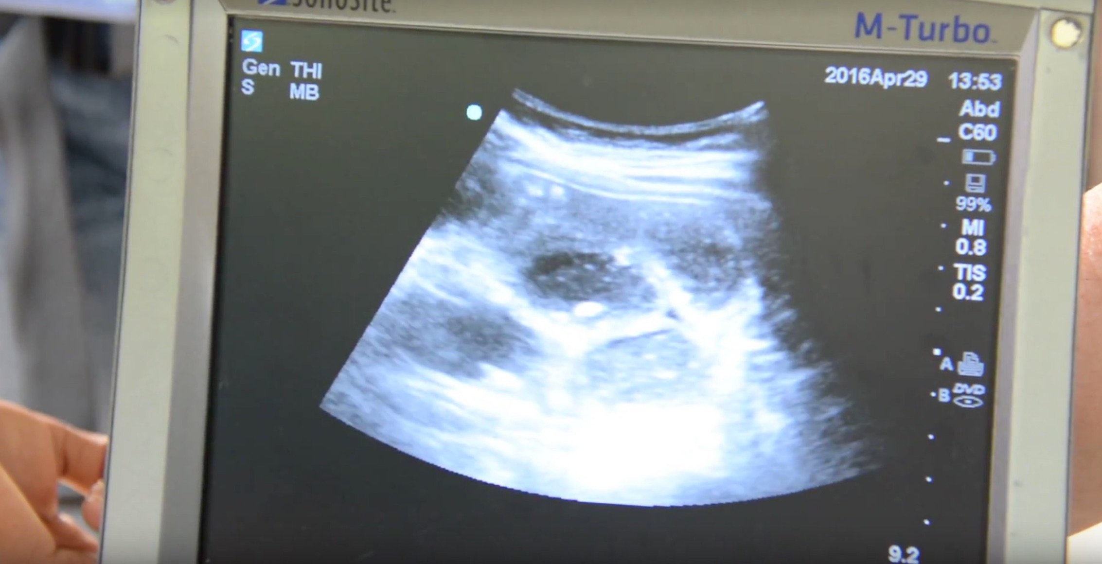 FIGURE 1. Portable ultrasound 