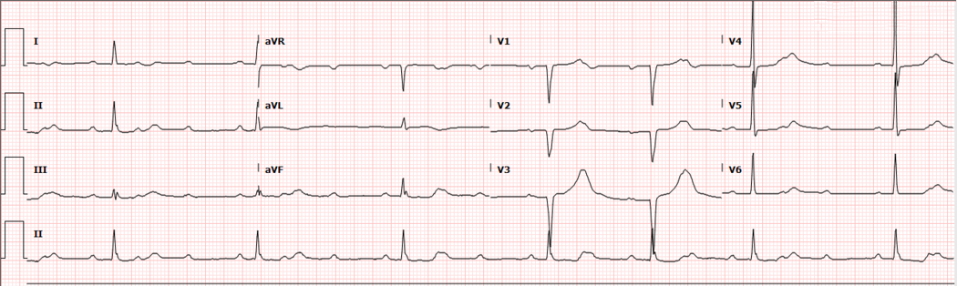 ECG Challenge