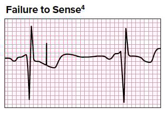 Failure to Sense