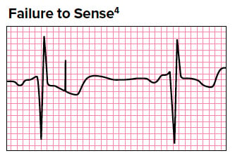 Failure to Sense