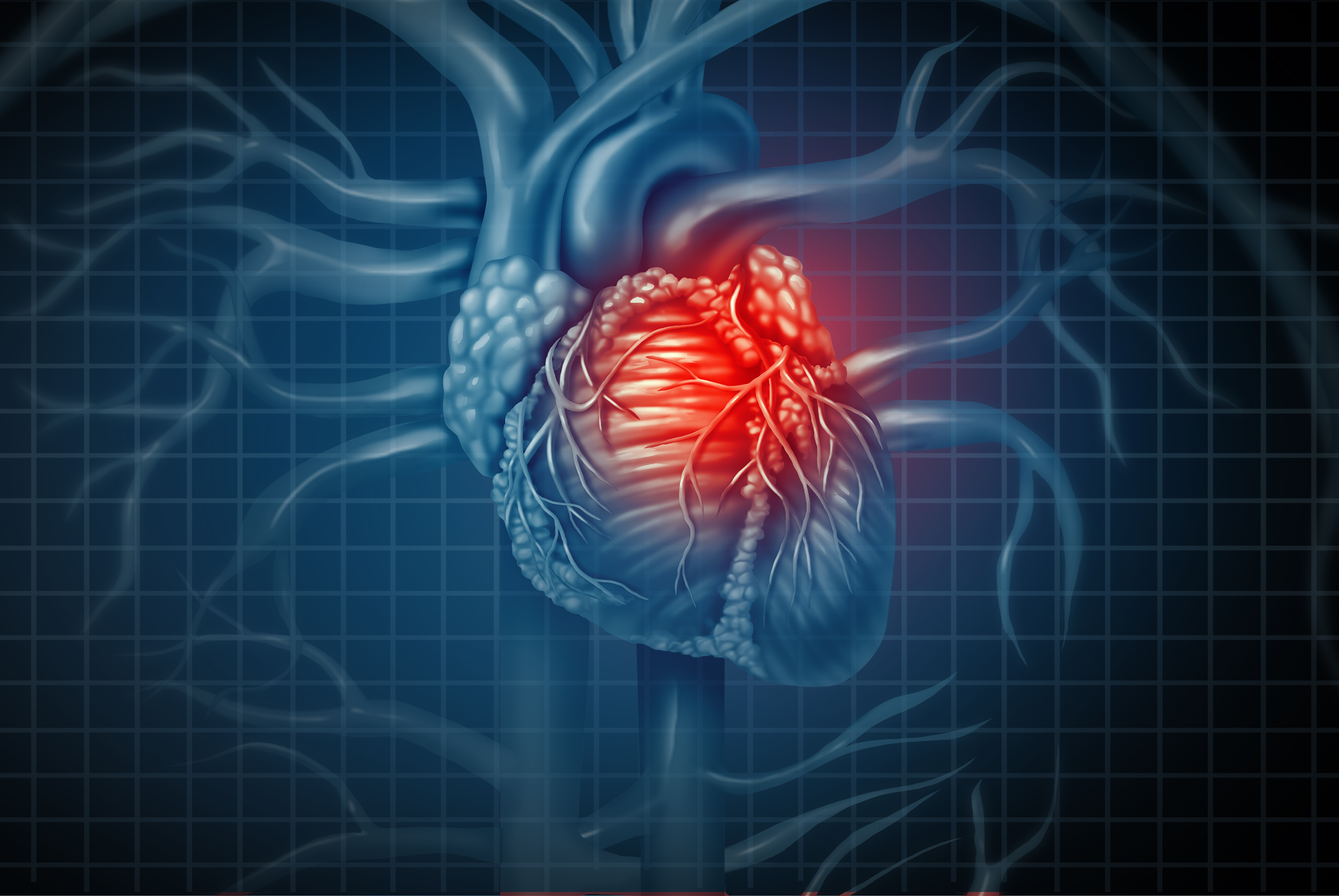 CritCare Alert - Angiography.jpg