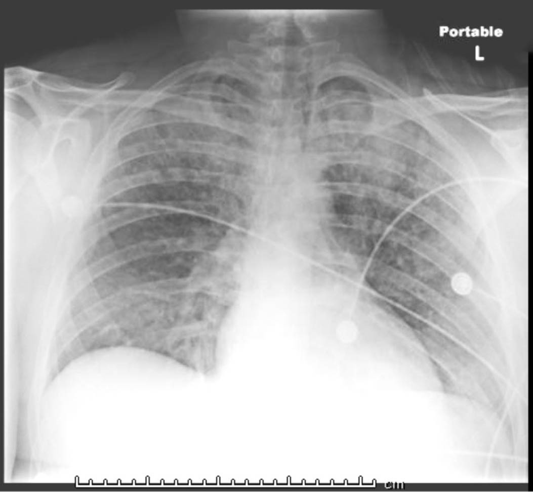 46-4 From Narcan to ECMO.jpg