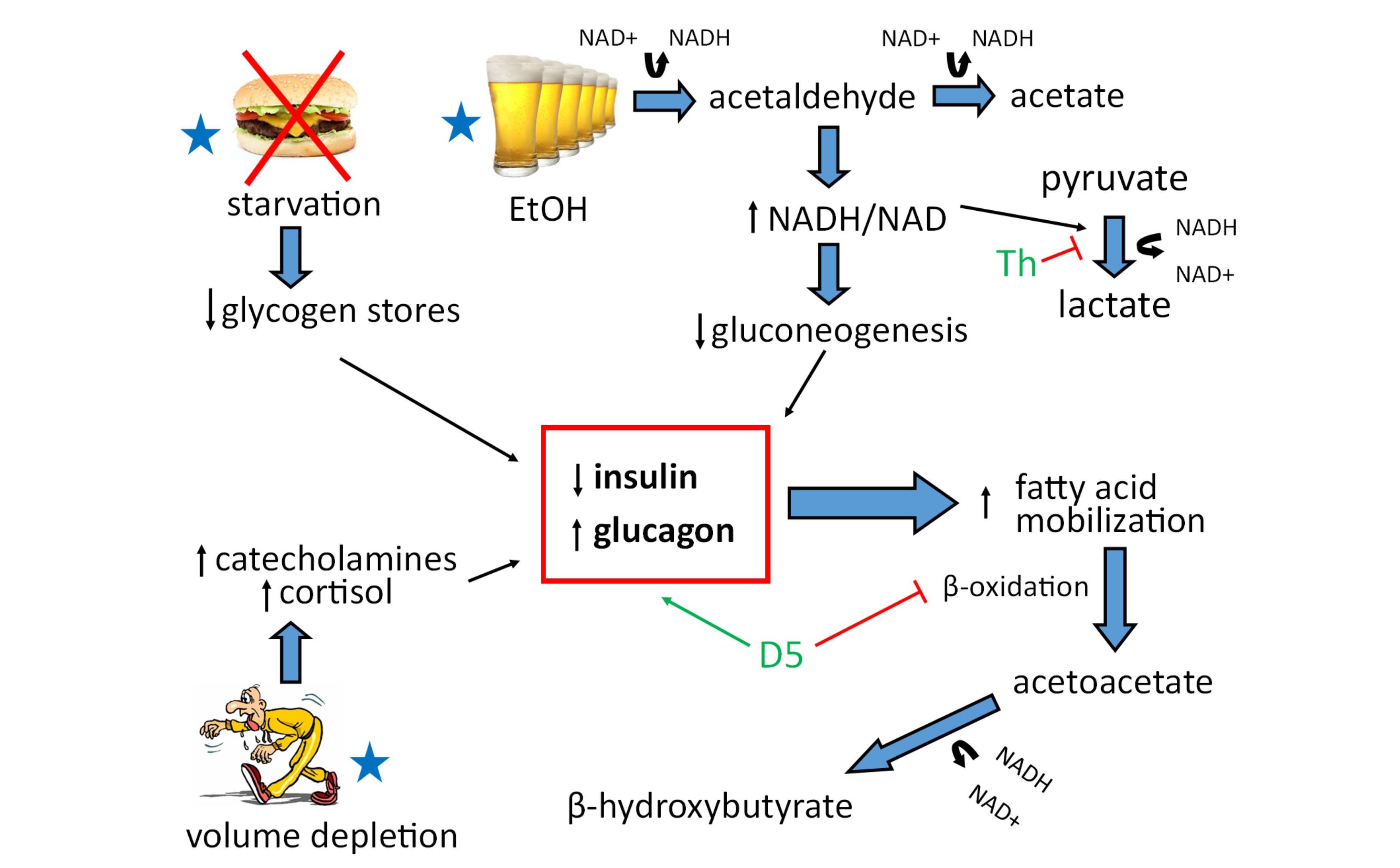 Alcoholic Ketoacidosis - Figure 1.jpg