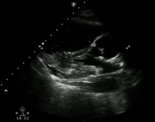 Figure 1. Parasternal long axis view