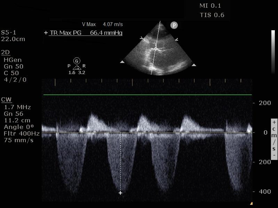 Figure 5. CW doppler spectral display