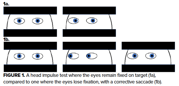 Head Impulse Test