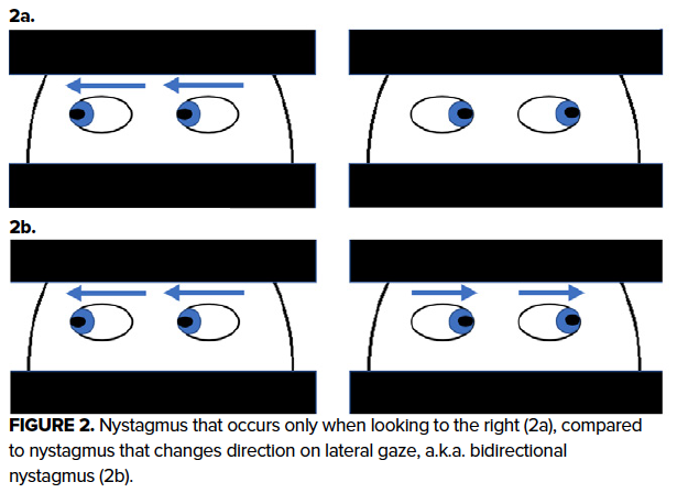 Nystagmus Test