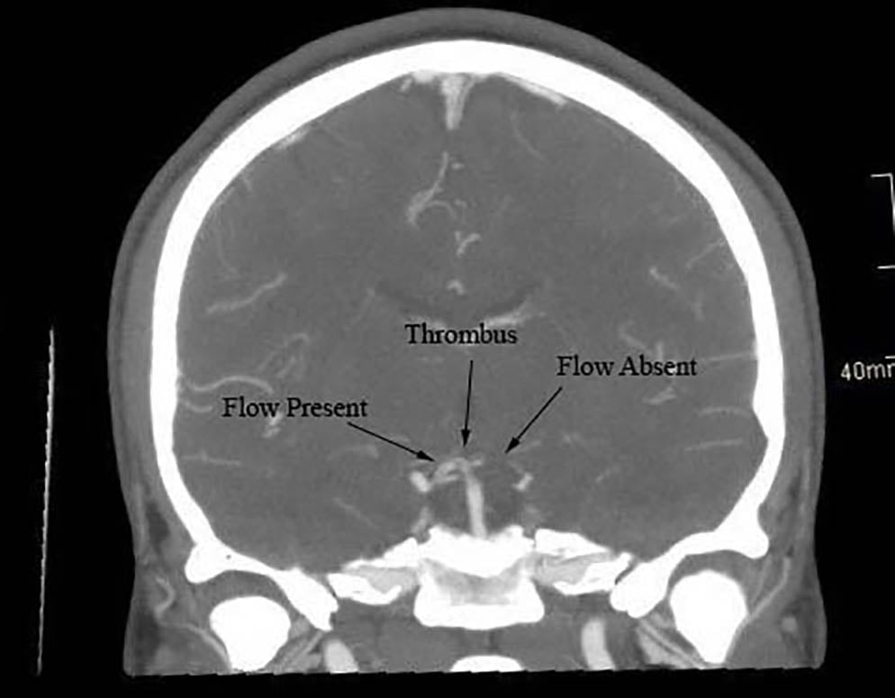 Jackhammer Dissection - Figure 2.jpg