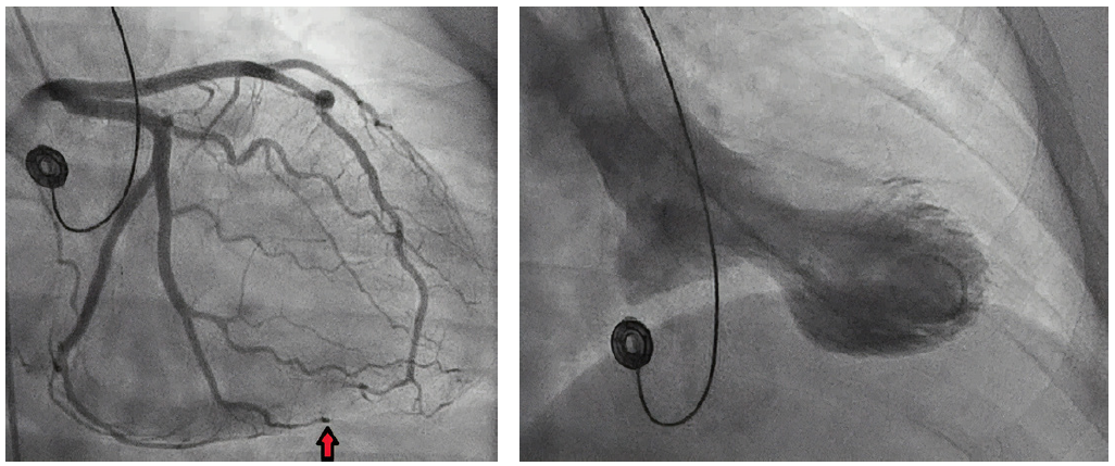 Figure 2 and 3