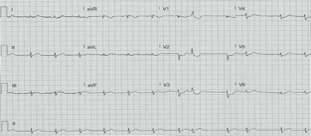 47-1 ECG Challenge Picture1.png