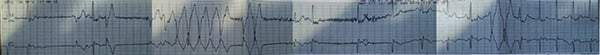 47-2 NSVT - Figure 2 REPLACEMENT_web.jpg